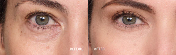 Byphasse Q10 HYDRA’CONFORT Eye Contour cream 20ML day & night